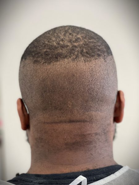 Afro donor