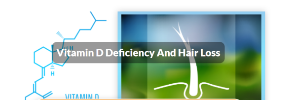 Male hair loss vitamin D